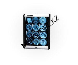 Негатоскоп Chammed однокадровый