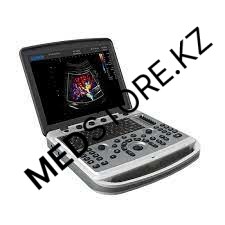 УЗИ Аппарат портативный CHISON SonoBook 6