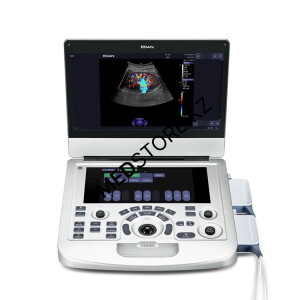 УЗИ Acclarix AX3 Edan – портативный ультразвуковой аппарат