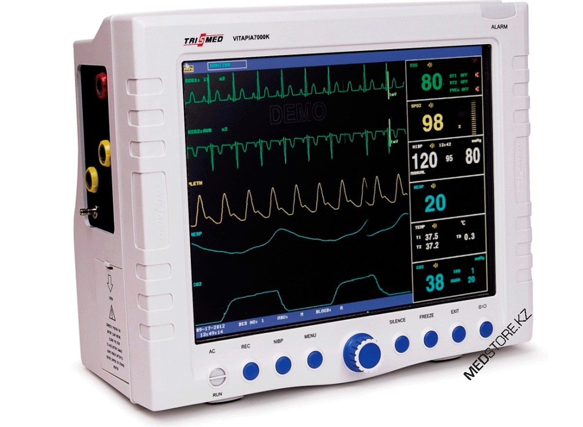 Монитор мультипараметровый пациента