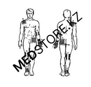 Углетканевые электроды для электрофореза (для Поток-1)