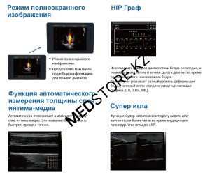 УЗИ Аппарат CHISON QBit 5
