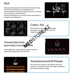 УЗИ аппарат Chison QBit 9