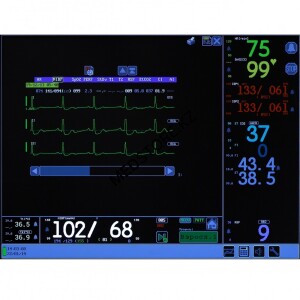 Монитор прикроватный реаниматолога и анестезиолога переносный МПР6-03, КОМПЛЕКТАЦИЯ Р1.19 (Тритон-ЭлектроникС ООО, РОССИЯ)