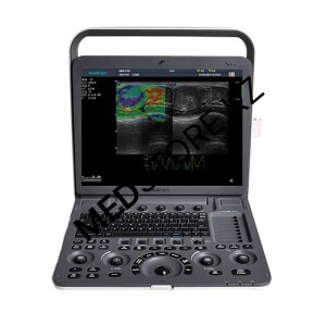 Система для ультразвуковой диагностики SonoScape S9Pro ( VISTA-платформа)